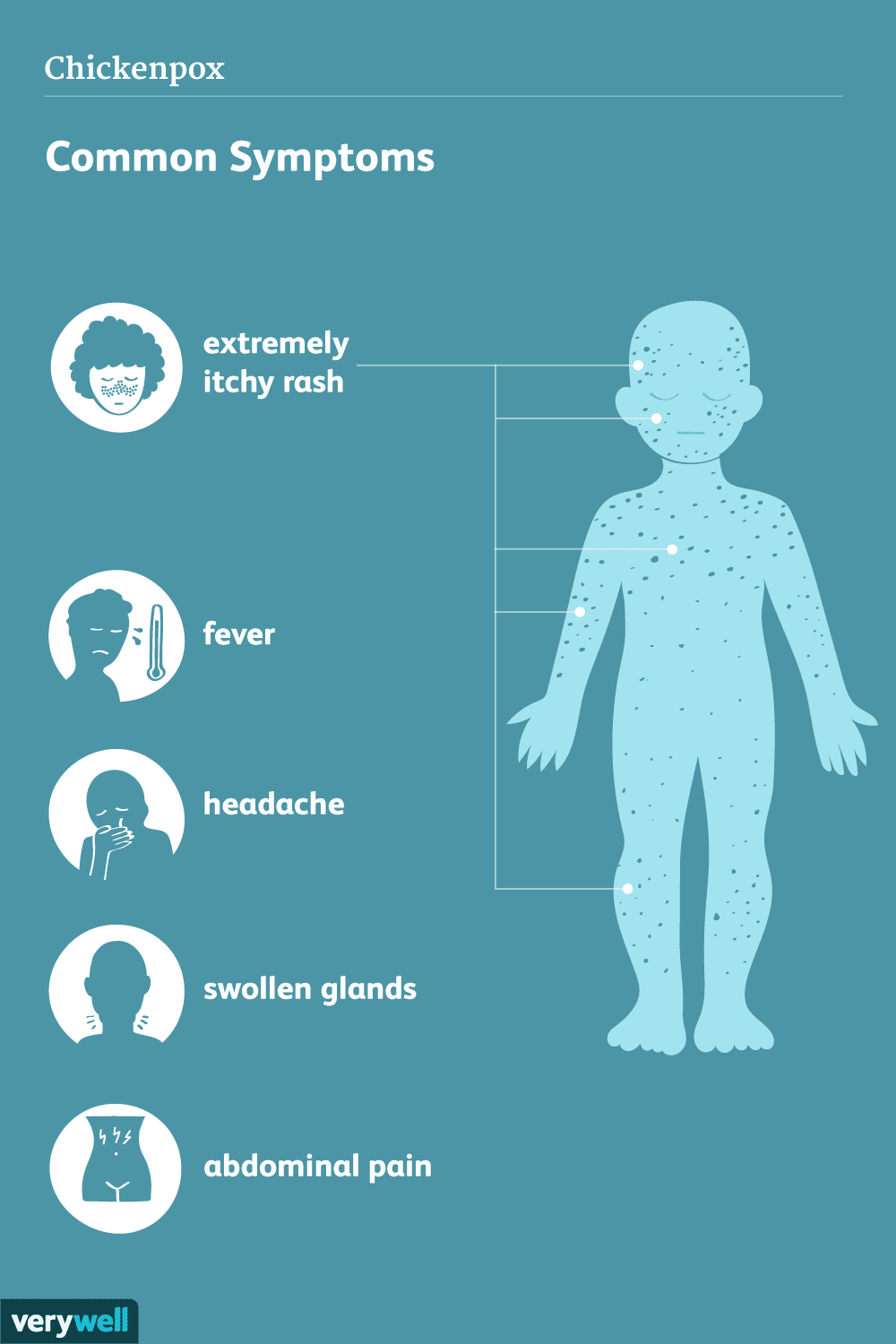 Understanding Chickenpox: Symptoms, Treatment & Recovery